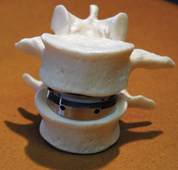 pain medicine Panama, Spine surgeon second opinion Panama City, Spine surgery second opinion Florida gulf coast, Second opinion for neck surgery Panama City, Spine surgeon Panama City, Spine surgeon Dothan, Laser spine surgery Florida Gulf Coast, Minimally invasive spine surgery Florida Panhandle, Home remedies for back pain Florida, Home remedies for back pain Panama City, Home remedy back pain Pensacola, Herniated disc Panhandle Florida, Non-surgical treatment options for back pain Florida, Artificial disc replacement neck Florida, physical therapy Panama
