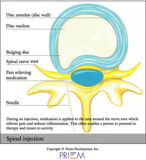injection therapy Panama City , spine injection therapy Panama City