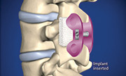 Surgical Options Panama City  spine center and neurosurgery center